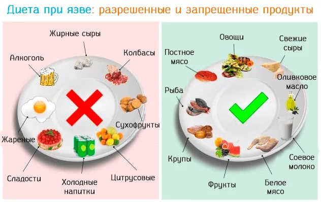 что можно кушать при язве желудка