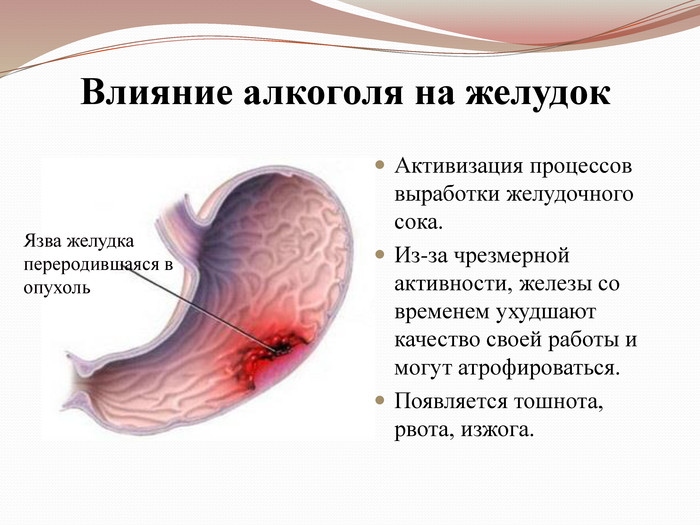 язва желудка и алкоголь