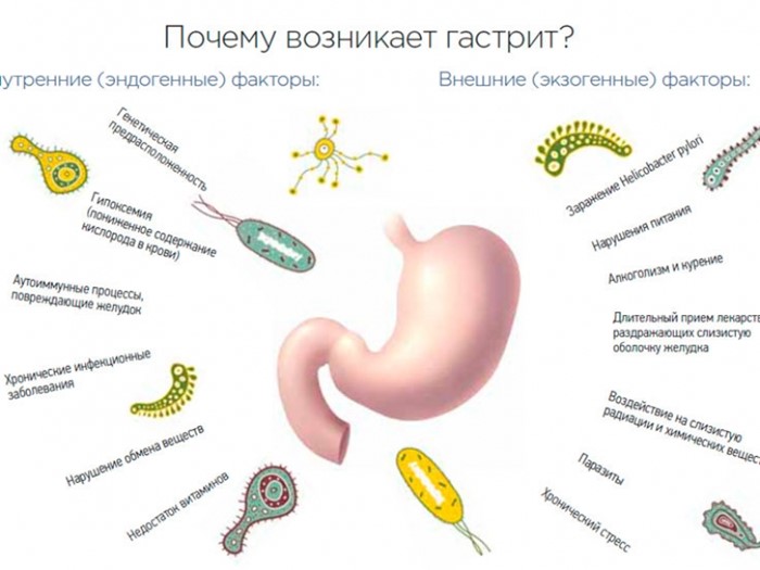 виды гастритов и их лечение