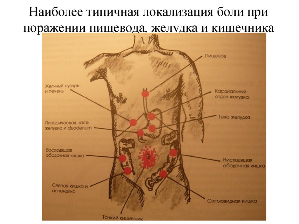 признаки гастрита симптомы где болит