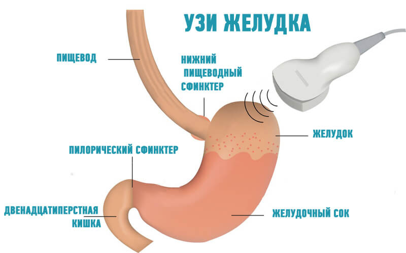 как проверить гастрит