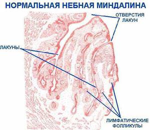 Глубокое промывание лакун Почему вакуумное промывание действеннее обычного
