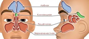 Острый катаральный пансинусит Виды пансинусита