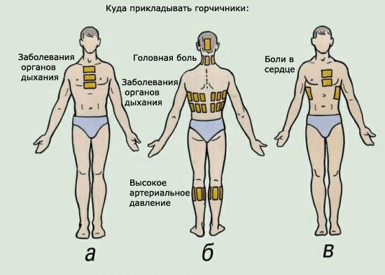 Куда можно ставить горчичники детям gorchichniki ot nasmorka